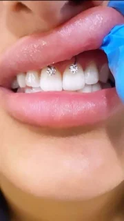 پیرسینگ اسمایل